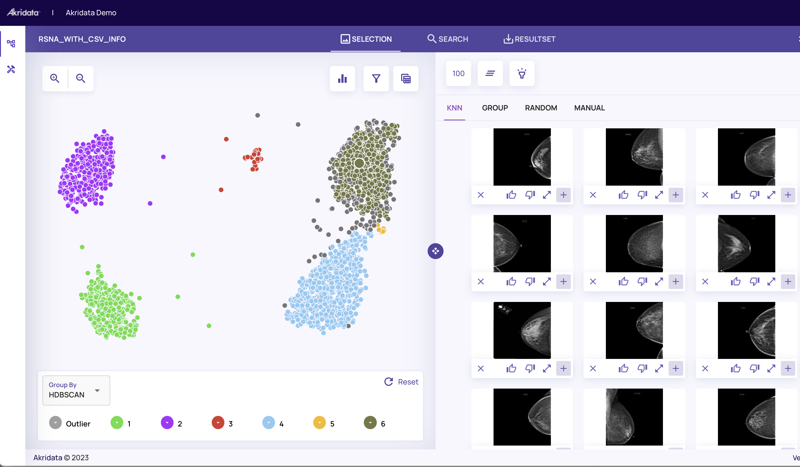 Best Kaggle Datasets For Data Analysis